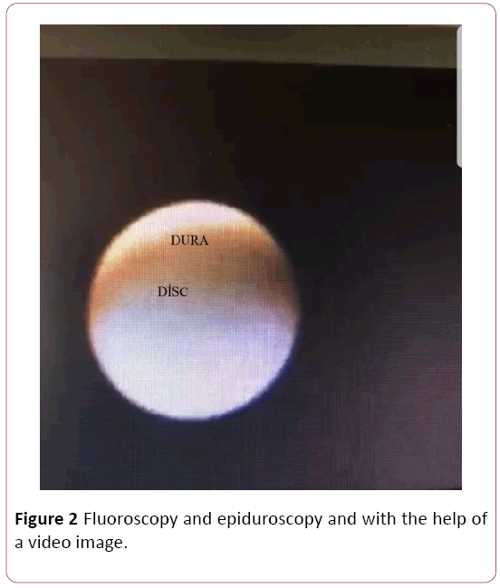 Annals-Clinical-Laboratory-Fluoroscopy-epiduroscopy