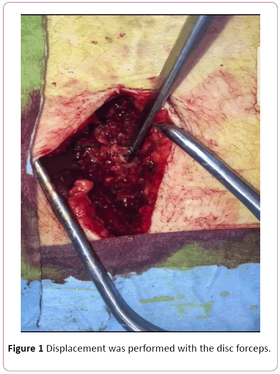 Annals-Clinical-Laboratory-disc-forceps